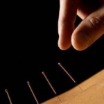 Acupuncture for Back Pain, Acupuncture for Depression, Acupuncture for Insomnia, Acupuncture for Hypertension